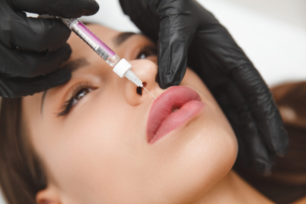 female lips, lip augmentation procedure. A syringe near a woman's mouth, injections to increase the shape of the lips